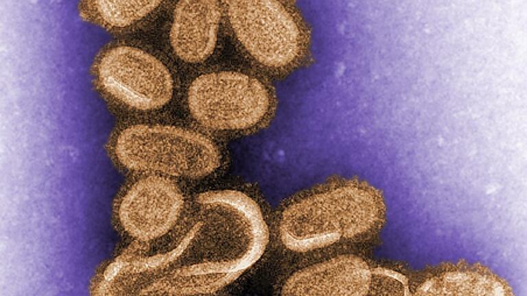 Spanische Grippe       -  Das aus einer Zellkultur nachgezüchtete Virus der Spanischen Grippe von 1918