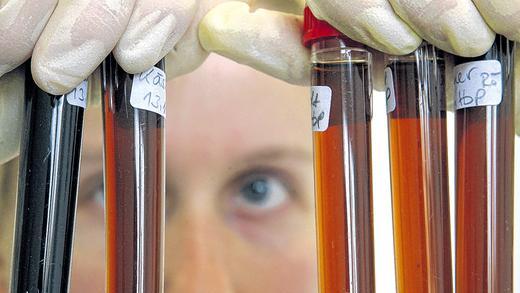 Der erste Schritt: Blut- und Knochenmarkanalysen sind nötig um einen geeigneten Stammzellen-Spender zu finden. Der erste Schritt: Blut- und Knochenmarkanalysen sind nötig um einen geeigneten Stammzellen-Spender zu finden.