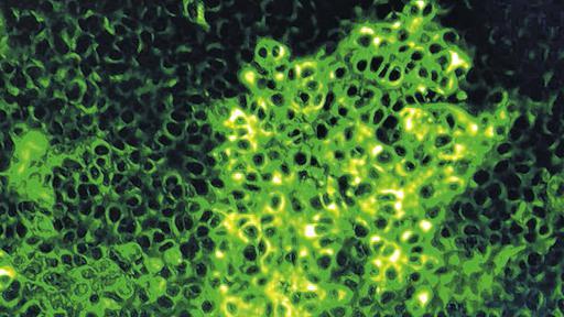 Aufgespürt: eine vom Schmallenberg-Virus infizierte Zellkultur am Friedrich-Loeffler-Institut für Tiergesundheit. Aufgespürt: eine vom Schmallenberg-Virus infizierte Zellkultur am Friedrich-Loeffler-Institut für Tiergesundheit.
