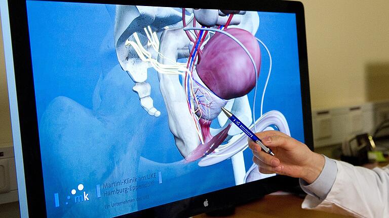 Ein Arzt zeigt in einem 3D-Modell die Prostata. Sitzt dort ein Tumor, muss dieser nicht immer entfernt werden. Die Ärzte entscheiden je nach Größe des Karzinoms – und auch nach Alter des Patients.&nbsp;