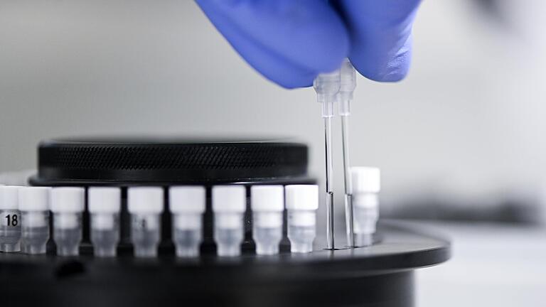 PCR-Test: Probenröhrchen zur Virus-Diagnostik, hier in einem Labor in Singen am Hohentwiel. PCR-Test: Probenröhrchen zur Virus-Diagnostik, hier in einem Labor in Singen am Hohentwiel.
