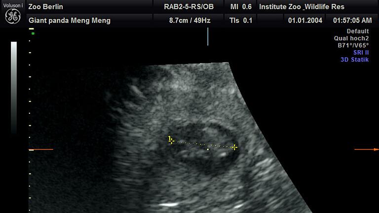 Ultraschall: Panda-Nachwuchs im Berliner Zoo erwartet       -  Die Babies sind etwa 2,5 Zentimeter groß. (Handout)