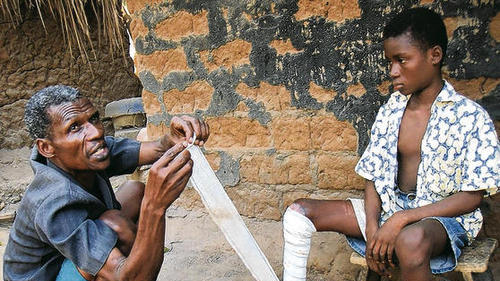 Der Großvater verbindet seinem Enkel das entstellte Bein. Wird Buruli Ulcer rechtzeitig erkannt, genügt ein kleiner Schnitt, manchmal sogar die Einnahme von Antibiotika. Ansonsten drohen Geschwüre, Verkrüppelungen oder Amputationen.       -  Der Großvater verbindet seinem Enkel das entstellte Bein. Wird Buruli Ulcer rechtzeitig erkannt, genügt ein kleiner Schnitt, manchmal sogar die Einnahme von Antibiotika. Ansonsten drohen Geschwüre, Verkrüppelungen oder Amputationen.