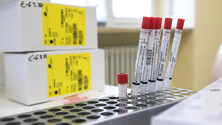 Im Raum Schweinfurt gibt es (Stand Freitag, 13. März) fünf Coronafälle. Das Foto entstand in der Teststation der Uniklinik in Würzburg. Im Raum Schweinfurt gibt es (Stand Freitag, 13. März) fünf Coronafälle. Das Foto entstand in der Teststation der Uniklinik in Würzburg.