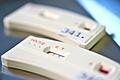 HIV-Schnelltest       -  HIV-Schnelltests zeigen an, ob jemand das Virus in sich trägt. (Archivbild)
