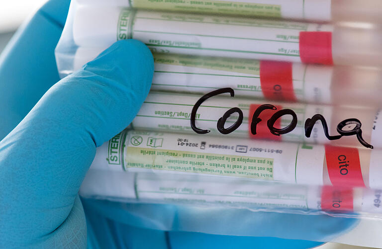 Die Labore sind bei der Auswertung der Corona-Tests längst an ihre Kapazitätsgrenzen gestoßen Die Labore sind bei der Auswertung der Corona-Tests längst an ihre Kapazitätsgrenzen gestoßen