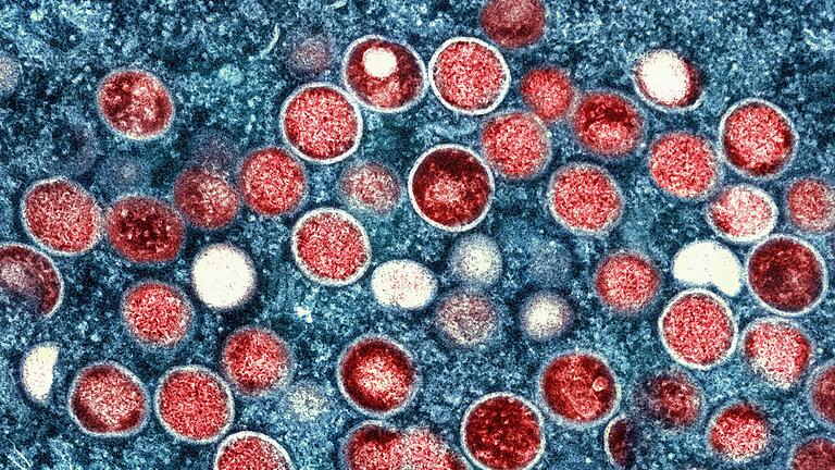 Mpox       -  Mpox-Virus-Partikel (rot) vermehren sich in den Zellen des Körpers. (Archivbild)